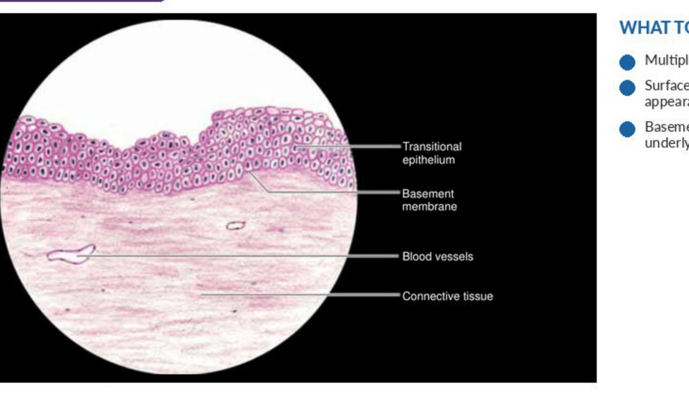 Labelled illustration of Transitional epithelium