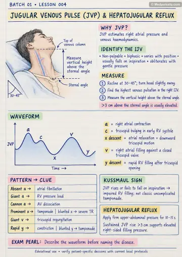 Handwritten one-page note: jugular venous pulse waves and abnormalities