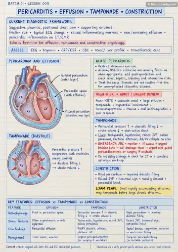Handwritten one-page note: pericarditis, effusion, tamponade and constriction