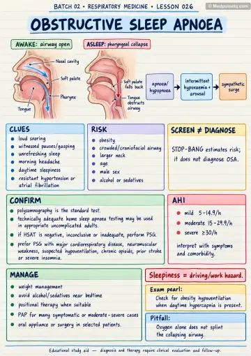Handwritten one-page note: obstructive sleep apnoea mechanism, clues and management