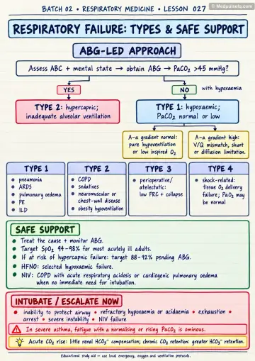 Handwritten one-page note: respiratory failure types and safe support