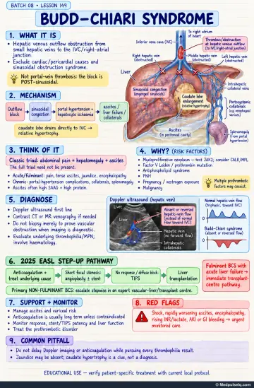 Handwritten one-page note: Budd-Chiari syndrome anatomy, risk factors, diagnosis, step-up treatment, and red flags