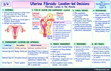 Handwritten one-page note: uterine fibroids FIGO classification, clinical features, investigations and location-led management