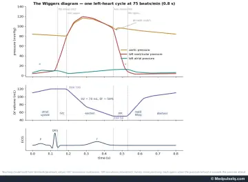 Graph: Wiggers diagram with aortic, left ventricular and left atrial pressures, LV volume and ECG over one 0.8-second cycle
