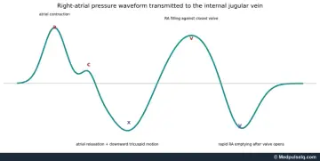 Graph: right atrial pressure waveform with a, c, x, v and y components