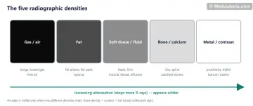Five shaded boxes from black to white: gas, fat, soft tissue or fluid, bone or calcium, metal or contrast