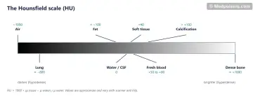 Grey gradient bar from −1000 to +1000 HU labelled air, lung, fat, water, soft tissue, fresh blood, calcification and bone