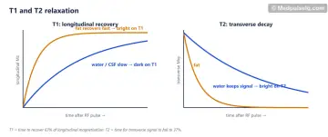 Two graphs: T1 recovery curves where fat recovers faster than water, and T2 decay curves where water keeps signal longer than fat
