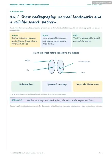 Visual notebook page — Chest radiography: normal landmarks and a reliable search pattern: what, how and why panels with a teaching schematic