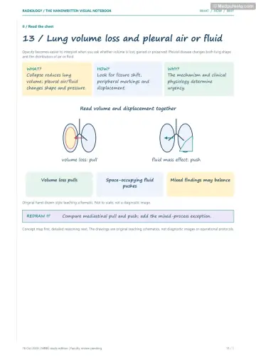 Visual notebook page — Lung volume loss and pleural air or fluid: what, how and why panels with a teaching schematic