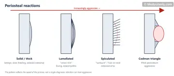 Four bone schematics showing solid, lamellated, spiculated and Codman triangle periosteal reactions, with an arrow of increasing aggressiveness