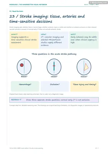 Visual notebook page — Stroke imaging: tissue, arteries and time-sensitive decisions: what, how and why panels with a teaching schematic